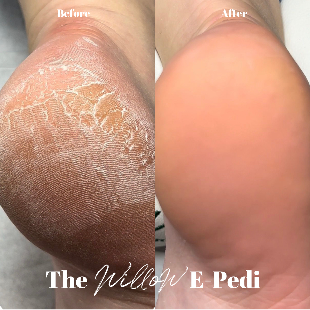 E-Pedi Course - Wales
